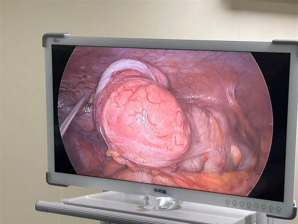 /images/companies/benhvienducgiang/images/2026/tháng 2/633871531_935939285438654_8366920294527469738_n.jpg